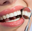 Nebenwirkungen von Zahnweiß-Methoden